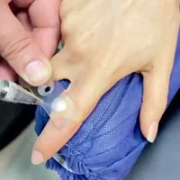 درمان زگیل تناسلی/لیزر/کرایو فریز/hpv/توسط پزشک|خدمات آرایشگری و زیبایی|اهواز, کیانپارس |دیوار