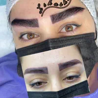 جشنواره ی باورنکردنی کاشت ابرو، کاشت مو، کاشت ریش|خدمات آرایشگری و زیبایی|تهران, نیاوران|دیوار