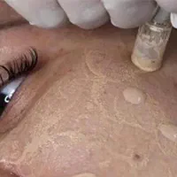 تکنیک مزووایت(روشن کننده پوست) کرمپودر دائم|خدمات آرایشگری و زیبایی|لاهیجان, انقلاب|دیوار