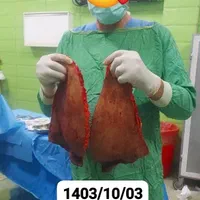 جراحی زیبایی عمل های تخصصی پیکرتراشی دکتریاب|خدمات آرایشگری و زیبایی|شیراز, زند|دیوار