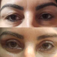 جذب پزشک متخصص و فوق تخصص چشم|استخدام درمانی، زیبایی، بهداشتی|تهران, قیطریه|دیوار
