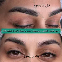 تخفیف ریموو تتو ابرو، خط چشم و لب در مرکز پوست غرب|خدمات آرایشگری و زیبایی|تهران, باغ فیض|دیوار