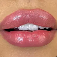ژل لب روسی/بوتاکس/فیلر زیر چشم/زاویه فک لیزر بدن|خدمات آرایشگری و زیبایی|تهران, ستارخان|دیوار