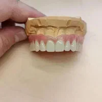 ساخت پروتزدندان مصنوعی لابراتواردندانسازی باضمانت|خدمات آرایشگری و زیبایی|فردیس, منظریه|دیوار