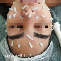 مدل مدل مدل برای فیشال درمانی