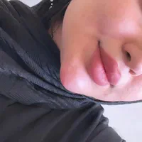 ژل بوتاکس،بلفاروپلاستی،پی آر پی،فیشیال ساکشن غبغب|خدمات آرایشگری و زیبایی|تبریز, |دیوار