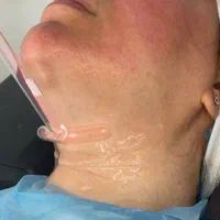 پاکسازی فیشیال صورت همراه آنالیزپوست،لیفت ابرو|خدمات آرایشگری و زیبایی|کرج, گوهردشت|دیوار