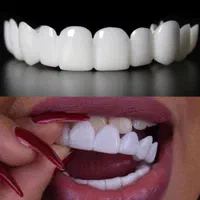 لمینت دندان پرداخت درب منزل
