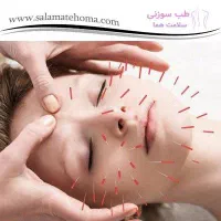 کارگاه آموزش جوانسازی پوست و لیفت با نخ-امبدینگ|خدمات آموزشی|تهران, فلسطین (میدان انقلاب)|دیوار