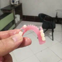 دندانسازی ساخت دندان مصنوعی|خدمات آرایشگری و زیبایی|تهران, اکباتان|دیوار