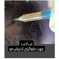 فیلرژل بوتاکس پی ارپی لاغر تزریق چربی مزولیزرهایفو|خدمات آرایشگری و زیبایی|تبریز, |دیوار