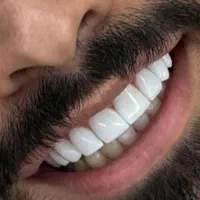 کلینیک زیبایی دندان « کامپوزیت و لمینیت اقساطی|خدمات آرایشگری و زیبایی|قم, باجک دو|دیوار