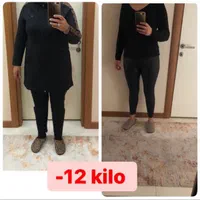 امبدینگ لاغری لیفت سینه وصورت با نخ