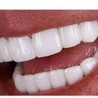 تخفیف ویژه کامپوزیت و لمینت با بهترین متخصصان|خدمات آرایشگری و زیبایی|شیراز, فرهنگ شهر|دیوار