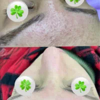 درمان تخصصی ،فیشال و اسیدتراپی و ماساژ درمانی صورت|خدمات آرایشگری و زیبایی|شیراز, رحمت‌آباد|دیوار