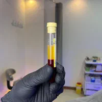 درمان تخصصی ریزش مو در کلینیک زیبایی راویس|خدمات آرایشگری و زیبایی|کاشان, رجایی|دیوار