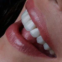 دندانپزشکی تخصصی ایمپلنت،کامپوزیت،ارتودنسی|خدمات آرایشگری و زیبایی|کرمانشاه, |دیوار