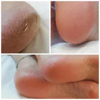 آموزش پدیکور درمانی و زیبایی به صورت تخصصی|خدمات آموزشی|مشهد, آزادشهر|دیوار