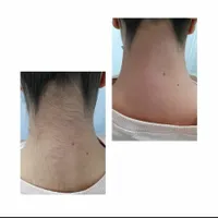 اپیلاسیون دائم،خالبرداری،لیفت ابرو،پارافین تراپی|خدمات آرایشگری و زیبایی|رشت, استقامت 2|دیوار