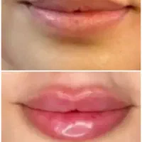 خدمات ژل وبوتاکس. تتو وانزیم وپرسینگ|خدمات آرایشگری و زیبایی|مشهد, شهرک شهید باهنر|دیوار
