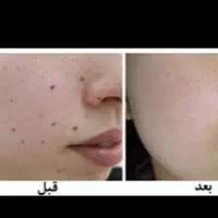 آموزش تتو بدن . پیرسینگ . چال گونه و برداشتن خال|خدمات آرایشگری و زیبایی|بروجرد, |دیوار