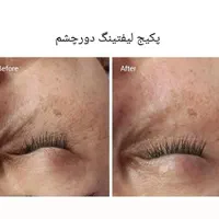 پاکسازی و فیشیال پوست|خدمات آرایشگری و زیبایی|اهواز, فاز ۲ پادادشهر|دیوار