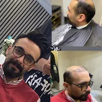 پروتز موی طبیعی|خدمات آرایشگری و زیبایی|شاهین دژ, |دیوار