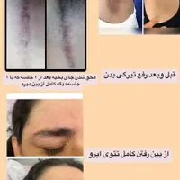 پیلینگ هالیوودی صورت و سفید کننده بیکینی|خدمات آرایشگری و زیبایی|کرج, گوهردشت|دیوار