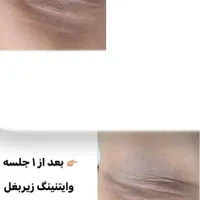 فیشال و خدمات تخصصی پوست توسط پیراپزشک در مطب پزشک|خدمات آرایشگری و زیبایی|مشهد, سجاد شهر|دیوار
