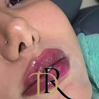 جشنواره ژل و بوتاکس|خدمات آرایشگری و زیبایی|اصفهان, مرداویج|دیوار