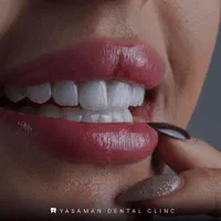 کامپوزیت طبیعی و لمینت /ایمپلنت و درمانی|خدمات آرایشگری و زیبایی|مشهد, جانباز|دیوار