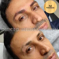 میکروبلیدینگ آقایان شیدینگ لب آقایان اسکالپ سر|خدمات آرایشگری و زیبایی|اصفهان, مرداویج|دیوار