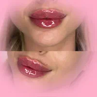 کلینیک تزریق ژل و بوتاکس آنزیم فیلر لب پزشک مطب|خدمات آرایشگری و زیبایی|کرج, گوهردشت|دیوار