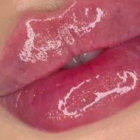 جشنواره تزریق ژللب متدm بوتاکس390لیزر آنزیم هایفو|خدمات آرایشگری و زیبایی|تهران, صادقیه|دیوار