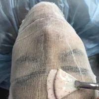 نیاز به مدل پاکسازی پوست تخصصی