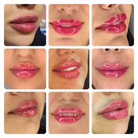 لیفت بایوفیس صورت مزو ژل بوتاکس اصلاح بینی نخ|خدمات آرایشگری و زیبایی|مشهد, احمدآباد|دیوار