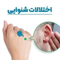 درمان طب سوزنی در مطب و منزل