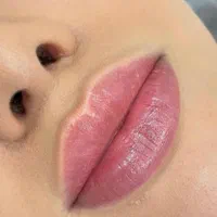 تخفیف تزریق ژل،ژل لب روسی تخصصی،بوتاکس