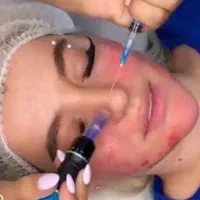جشنواره آموزش و خدمات فیشیال و پاکسازی پوست|خدمات آرایشگری و زیبایی|کرج, گوهردشت|دیوار