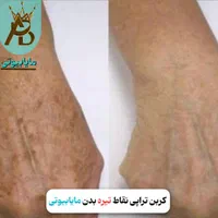 اولین مرکز روشن کننده بیکینی و زیربغل،مایابیوتی|خدمات آرایشگری و زیبایی|یاسوج, |دیوار