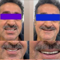 دندانسازی میعاد دندان مصنوعی|خدمات آرایشگری و زیبایی|کرمان, |دیوار