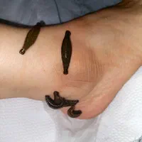 زالودرمانی حجامت طب سوزنی فیزیوتراپی درمنزل|خدمات آرایشگری و زیبایی|تهران, گرگان|دیوار