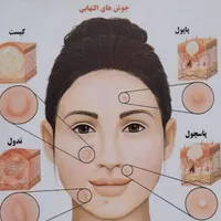 آموزش فشیال و پاکسازی/احیاءوکراتین مو+استخدام