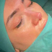 جشنواره جراحی بینی و پیکر تراشی|خدمات آرایشگری و زیبایی|همدان, |دیوار