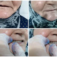 دندانسازی مصنوعی حرفه ای برای همه لبخندها|خدمات آرایشگری و زیبایی|مشهد, کوی سیدی|دیوار
