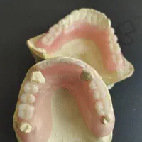 ساخت دست دندان و رفع لقی و شکستگی|خدمات آرایشگری و زیبایی|تهران, سبلان (لشگر)|دیوار