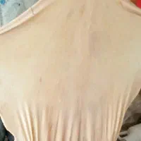 پوست دمام  دباغی