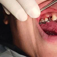 مرکز دندانپزشکی تخصصی|خدمات آرایشگری و زیبایی|اصفهان, عباس‌آباد|دیوار