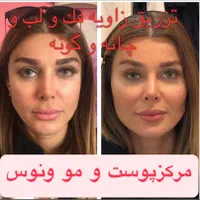 کلینیک تزریق ژل لب روسیm بوتاکس چشم گربه،لیفت،لیزر
