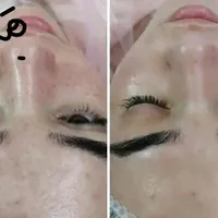 تکنیک مزووایت(روشن کننده پوست) کرمپودر دائم